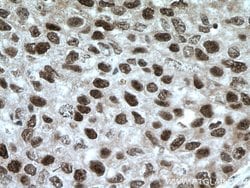 XRCC4 Rabbit anti-Human, Rat, Polyclonal, Proteintech 150 &mu;L; Unconjugated:Antibodies,