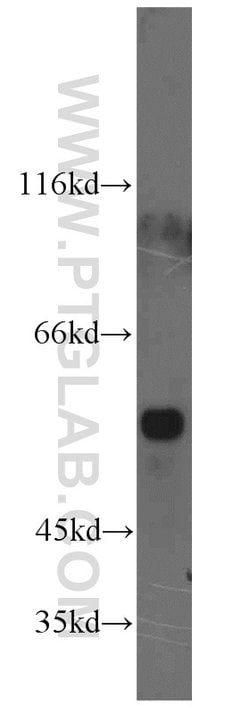XRCC4 Rabbit anti-Human, Rat, Polyclonal, Proteintech 150 &mu;L; Unconjugated:Antibodies,
