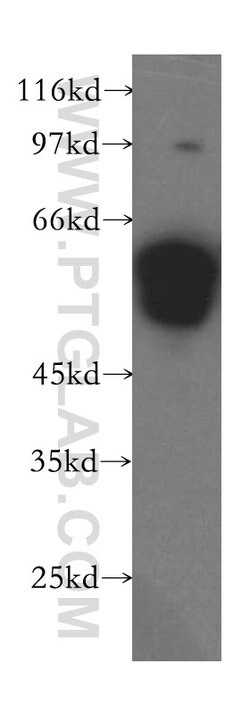 XRCC4 Rabbit anti-Human, Rat, Polyclonal, Proteintech 150 &mu;L; Unconjugated:Antibodies,
