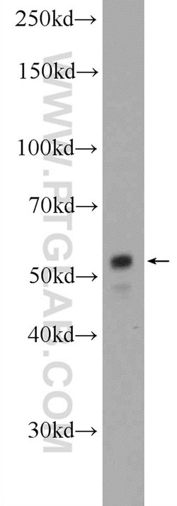 XRCC4 Rabbit anti-Human, Rat, Polyclonal, Proteintech 150 &mu;L; Unconjugated:Antibodies,