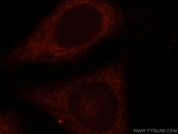 HMMR Rabbit anti-Human, Mouse, Rat, Polyclonal, Proteintech:Antibodies:Primary