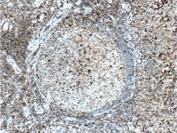 HMMR Rabbit anti-Human, Mouse, Rat, Polyclonal, Proteintech:Antibodies:Primary