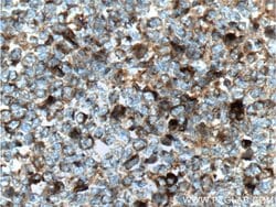 HMMR Rabbit anti-Human, Mouse, Rat, Polyclonal, Proteintech:Antibodies:Primary