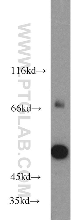 HMMR Rabbit anti-Human, Mouse, Rat, Polyclonal, Proteintech:Antibodies:Primary