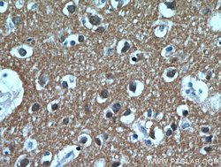 PKM1 Rabbit anti-Human, Mouse, Rat, Polyclonal, Proteintech 150 &mu;L;