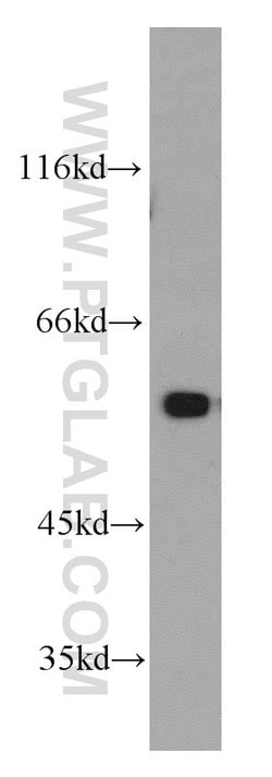 PKM1 Rabbit anti-Human, Mouse, Rat, Polyclonal, Proteintech 150 &mu;L;