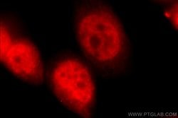 PKM1 Rabbit anti-Human, Mouse, Rat, Polyclonal, Proteintech 150 &mu;L;