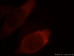 PKM2 Rabbit anti-Human, Mouse, Polyclonal, Proteintech 150 &mu;L; Unconjugated:Antibodies,