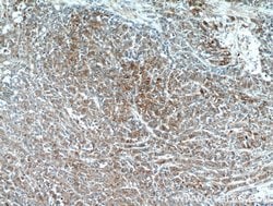 PKM2 Rabbit anti-Human, Mouse, Polyclonal, Proteintech 150 &mu;L; Unconjugated:Antibodies,
