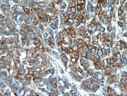 PKM2 Rabbit anti-Human, Mouse, Polyclonal, Proteintech 150 &mu;L; Unconjugated:Antibodies,