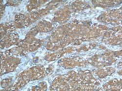 PKM2 Rabbit anti-Human, Mouse, Polyclonal, Proteintech 150 &mu;L; Unconjugated:Antibodies,