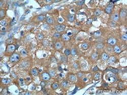 PKM2 Rabbit anti-Human, Mouse, Polyclonal, Proteintech 150 &mu;L; Unconjugated:Antibodies,