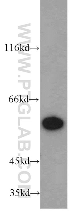 PKM2 Rabbit anti-Human, Mouse, Polyclonal, Proteintech 150 &mu;L; Unconjugated:Antibodies,