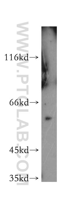 PKM2 Rabbit anti-Human, Mouse, Polyclonal, Proteintech 150 &mu;L; Unconjugated:Antibodies,