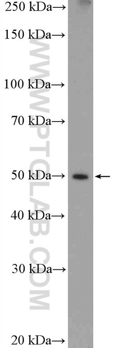 PKM2 Rabbit anti-Human, Mouse, Polyclonal, Proteintech 150 &mu;L; Unconjugated:Antibodies,