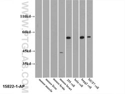 PKM2 Rabbit anti-Human, Mouse, Polyclonal, Proteintech 150 &mu;L; Unconjugated:Antibodies,