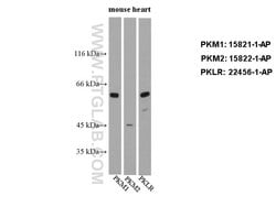 PKM2 Rabbit anti-Human, Mouse, Polyclonal, Proteintech 150 &mu;L; Unconjugated:Antibodies,