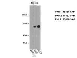 PKM2 Rabbit anti-Human, Mouse, Polyclonal, Proteintech 150 &mu;L; Unconjugated:Antibodies,
