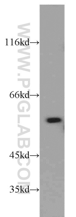 PKM2 Rabbit anti-Human, Mouse, Polyclonal, Proteintech 150 &mu;L; Unconjugated:Antibodies,