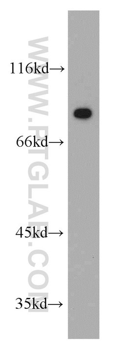 PKM2 Rabbit anti-Human, Mouse, Polyclonal, Proteintech 150 &mu;L; Unconjugated:Antibodies,