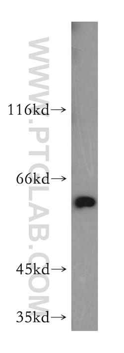 PKM2 Rabbit anti-Human, Mouse, Polyclonal, Proteintech 150 &mu;L; Unconjugated:Antibodies,