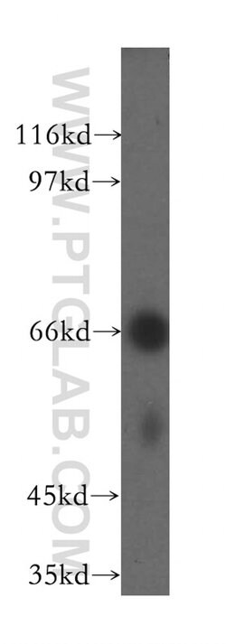 UBASH3A Rabbit anti-Human, Mouse, Rat, Polyclonal, Proteintech:Antibodies:Primary