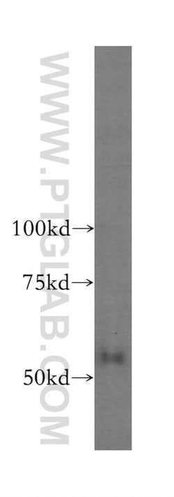 domain-I-of-FIZ-1 Rabbit anti-Human, Mouse, Rat, Polyclonal, Proteintech