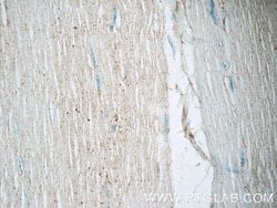 domain-I-of-FIZ-1 Rabbit anti-Human, Mouse, Rat, Polyclonal, Proteintech