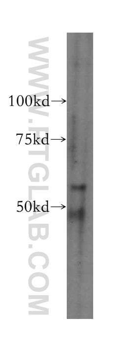 domain-I-of-FIZ-1 Rabbit anti-Human, Mouse, Rat, Polyclonal, Proteintech