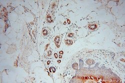 GARS Rabbit anti-Human, Mouse, Rat, Polyclonal, Proteintech:Antibodies:Primary