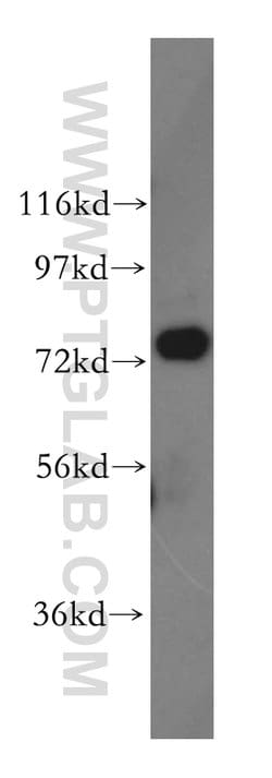 GARS Rabbit anti-Human, Mouse, Rat, Polyclonal, Proteintech:Antibodies:Primary