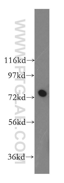 GARS Rabbit anti-Human, Mouse, Rat, Polyclonal, Proteintech:Antibodies:Primary