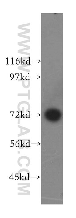 GARS Rabbit anti-Human, Mouse, Rat, Polyclonal, Proteintech:Antibodies:Primary