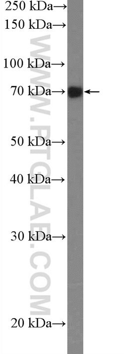 GARS Rabbit anti-Human, Mouse, Rat, Polyclonal, Proteintech:Antibodies:Primary