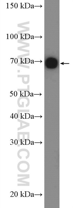 GARS Rabbit anti-Human, Mouse, Rat, Polyclonal, Proteintech:Antibodies:Primary
