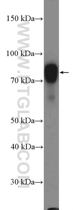 GARS Rabbit anti-Human, Mouse, Rat, Polyclonal, Proteintech:Antibodies:Primary