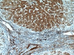 Vitronectin Rabbit anti-Human, Mouse, Rat, Polyclonal, Proteintech:Antibodies:Primary