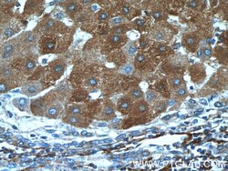 Vitronectin Rabbit anti-Human, Mouse, Rat, Polyclonal, Proteintech:Antibodies:Primary