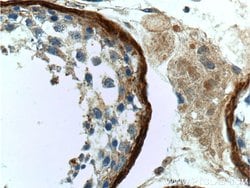 Vitronectin Rabbit anti-Human, Mouse, Rat, Polyclonal, Proteintech:Antibodies:Primary
