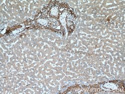 Vitronectin Rabbit anti-Human, Mouse, Rat, Polyclonal, Proteintech:Antibodies:Primary