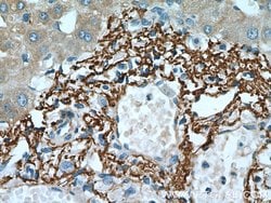 Vitronectin Rabbit anti-Human, Mouse, Rat, Polyclonal, Proteintech:Antibodies:Primary