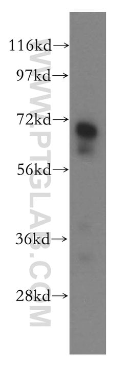 Vitronectin Rabbit anti-Human, Mouse, Rat, Polyclonal, Proteintech:Antibodies:Primary