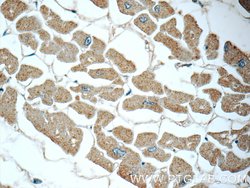 GSTT1 Rabbit anti-Human, Mouse, Rat, Polyclonal, Proteintech 150 &mu;L;