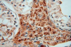 GSTT1 Rabbit anti-Human, Mouse, Rat, Polyclonal, Proteintech 150 &mu;L;