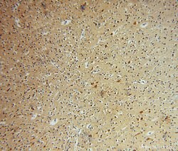 GSTT1 Rabbit anti-Human, Mouse, Rat, Polyclonal, Proteintech 150 &mu;L;