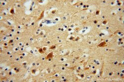 GSTT1 Rabbit anti-Human, Mouse, Rat, Polyclonal, Proteintech 150 &mu;L;