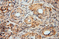GSTT1 Rabbit anti-Human, Mouse, Rat, Polyclonal, Proteintech 150 &mu;L;