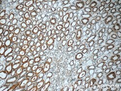 GSTT1 Rabbit anti-Human, Mouse, Rat, Polyclonal, Proteintech 150 &mu;L;