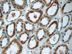 GSTT1 Rabbit anti-Human, Mouse, Rat, Polyclonal, Proteintech 150 &mu;L;