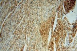 GSTT1 Rabbit anti-Human, Mouse, Rat, Polyclonal, Proteintech 150 &mu;L;